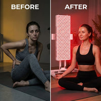 Red Light Therapy Device with Stand - Moving Pro Series Professional Edition — Before & After